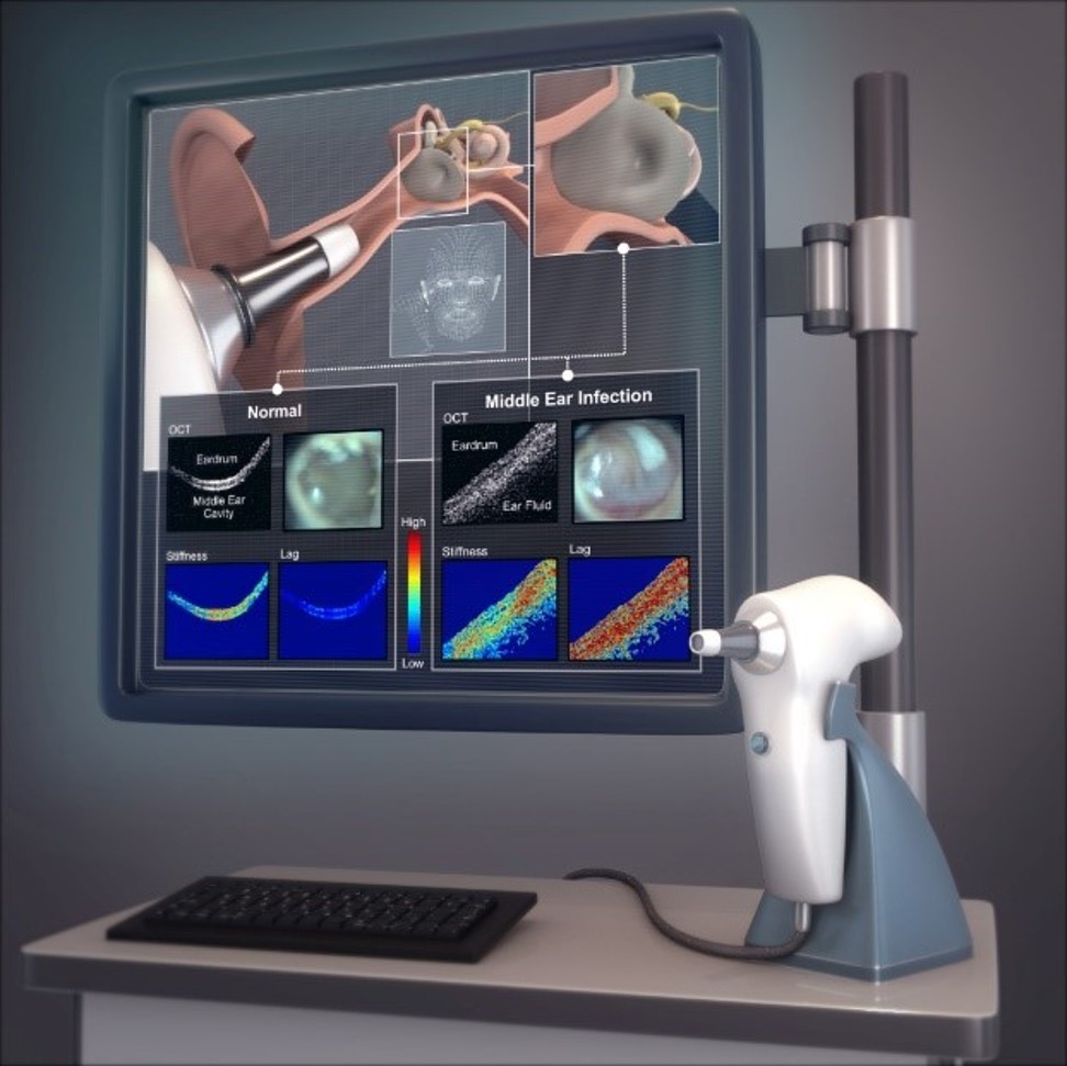 Ear drum dynamics